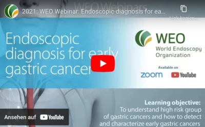 Endoscopic diagnosis for early gastric cancer